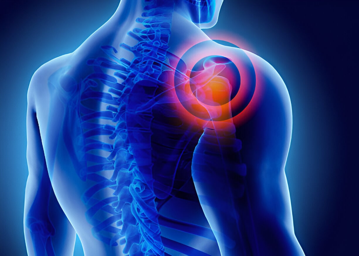 Cervical spinal pain stem cell treatment