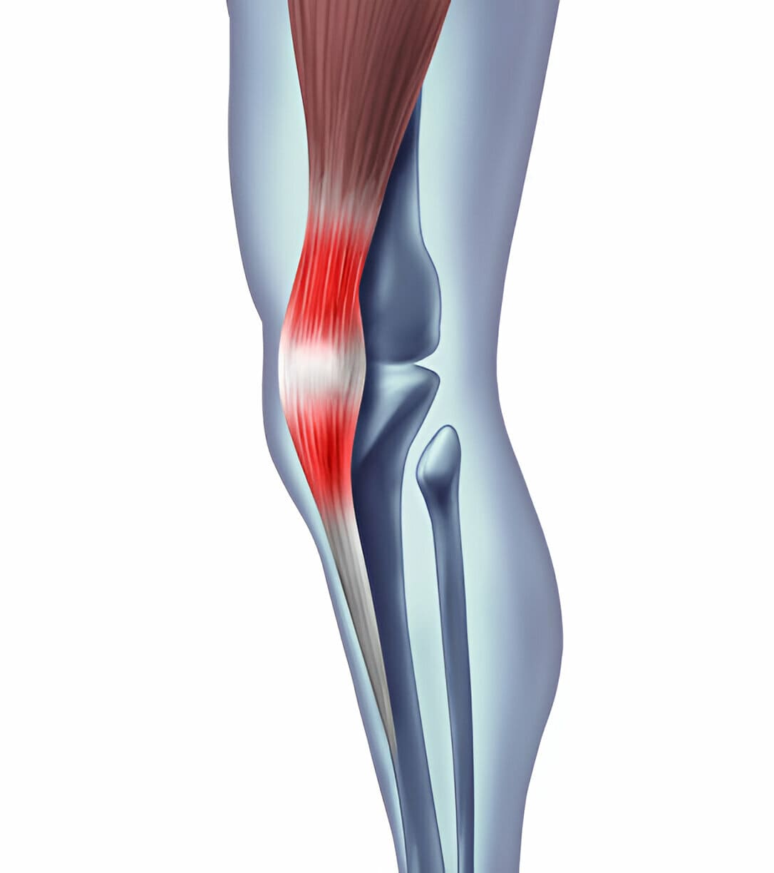 Cervical spinal pain stem cell treatment
