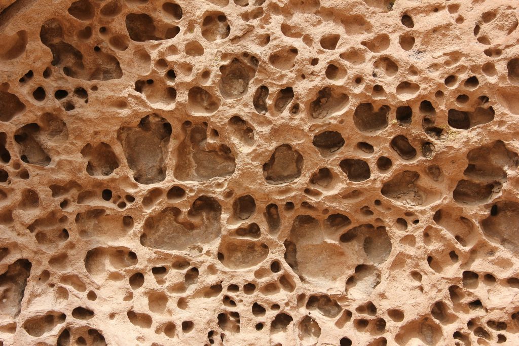 Abstract artwork representing bone marrow cells used in regenerative therapy for aneurysmal bone cysts.