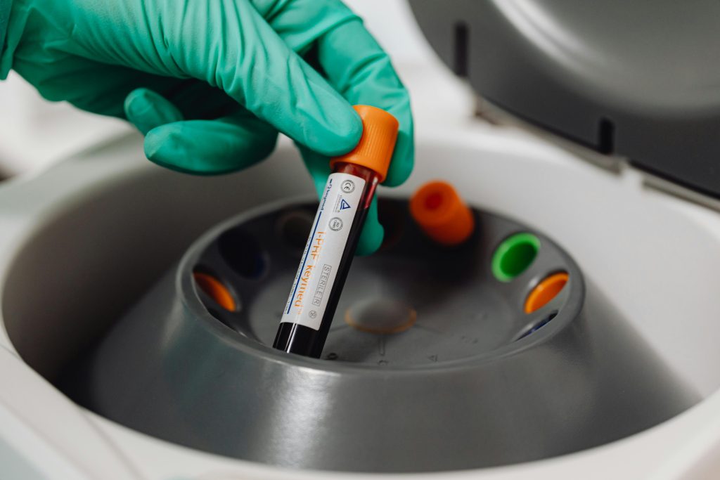 Scientist placing a vial of blood into a centrifuge to analyze biomarkers for biological age testing.